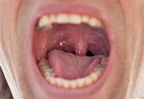 Can You Sneeze Out a Tonsil Stone? Exploring the Oddities of Human Anatomy and Bodily Functions